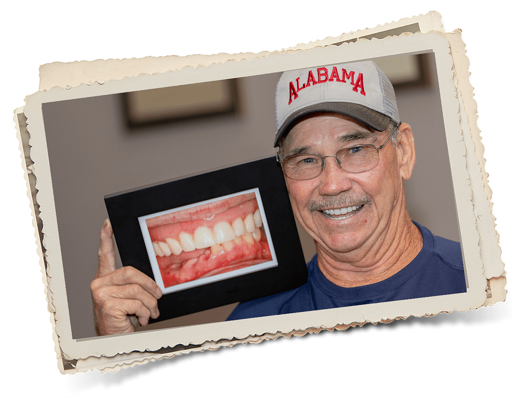 Patient showing a picture of a before and after after implant supported denture treatment at Dr Felts Dr Felts and his daughter Dr Felts Randall Chattanooga TN