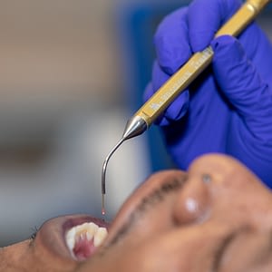 Laser Dentistry technology