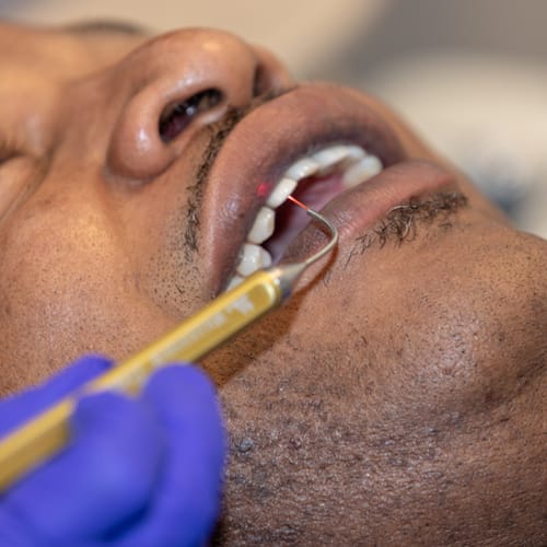 A patient getting LANAP treatment at Chattanooga Periodontics & Dental Implants Chattanooga TN